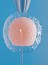 IVF Treatment